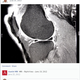 Image for article titled We’d all be better off with our health records on Facebook